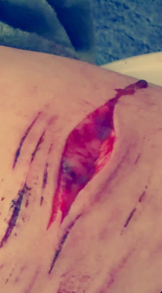 s1vtcutz's tweet photo. my new halloween makeup sesh 🦇ALL FAKE 🦇 SFX MAKEUP HALLOWEEN PRACTICE !all fake! AI enhanced #shedtwtt #slittwt https://t.co/KSlx2zaNcz
