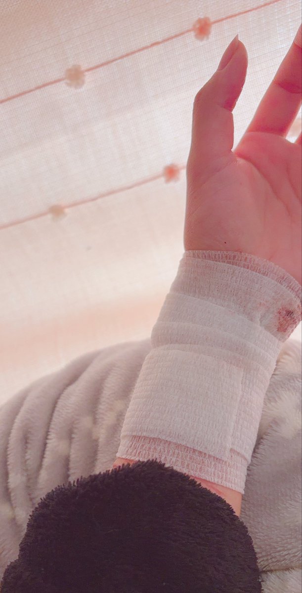 Hicvn4456's tweet photo. ちゃんと手当して寝たよ 過量服薬繰り返してる血液なんて献血に無用だろ https://t.co/NhLgc6qrOn
