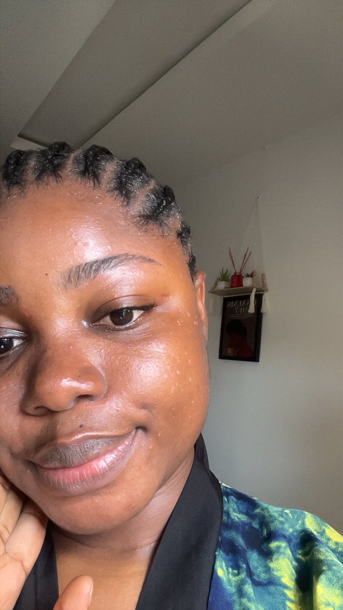 TuruchiP's tweet photo. Skin tags really dealt with me 🥹😩
Thank God for @lusciousbyLisa spa… I for too cry 😩. https://t.co/watAZJZcUE