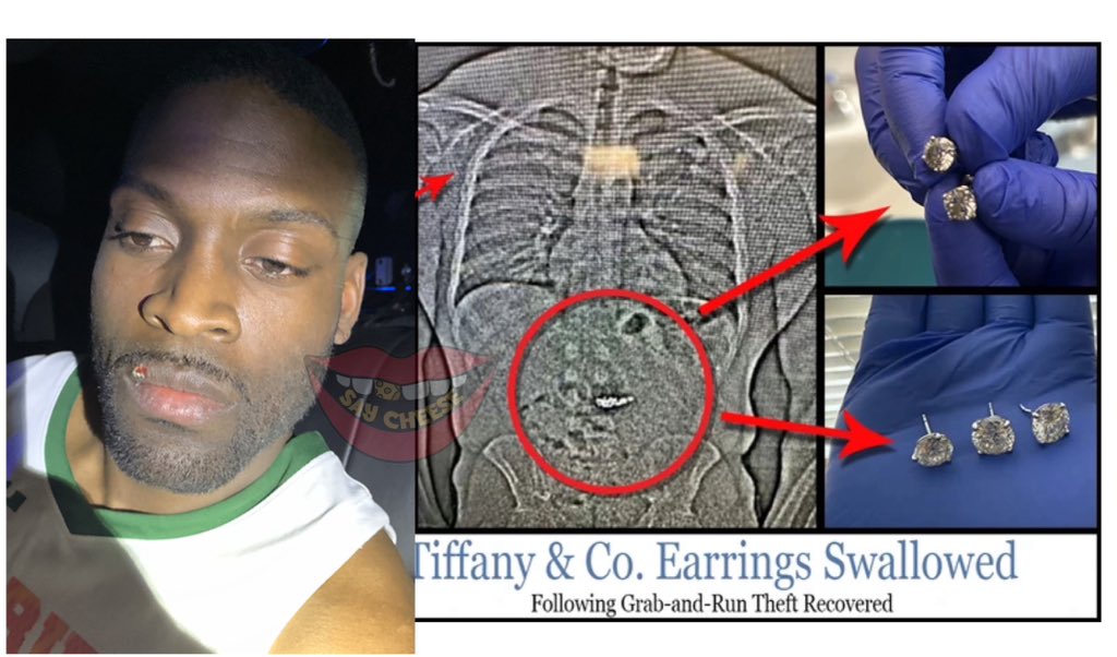SaycheeseDGTL's tweet photo. Florida Man found guilty after stealing $769K worth of diamond earrings from Tiffany &amp; Co. and SWALLOWING them to hide the evidence 😳💎 https://t.co/DuE8UWIuSe