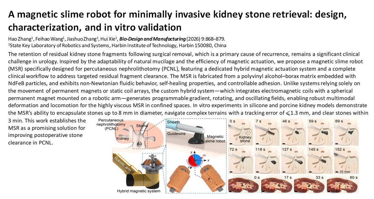 BioDesignManuf's tweet photo. A magnetic slime robot for minimally invasive kidney stone retrieval: design, characterization, and in vitro validation

Learn more: https://t.co/NdsoDBmSDA https://t.co/lh2lYP8T1q