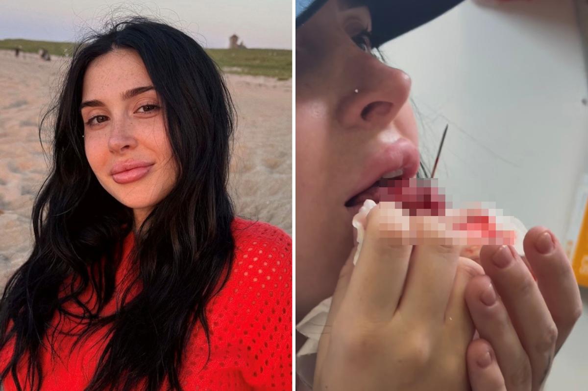 nypost's tweet photo. Shady NYC piercing shop butchered woman's tongue, sending her to ER: lawsuit https://t.co/SkdyOGcam2 https://t.co/Vver005QqA