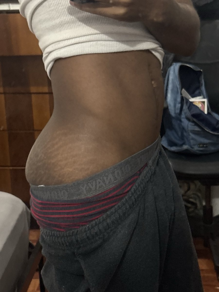 VULTUREXVON's tweet photo. tap to reveal 🍑 https://t.co/nHIyOKPG86