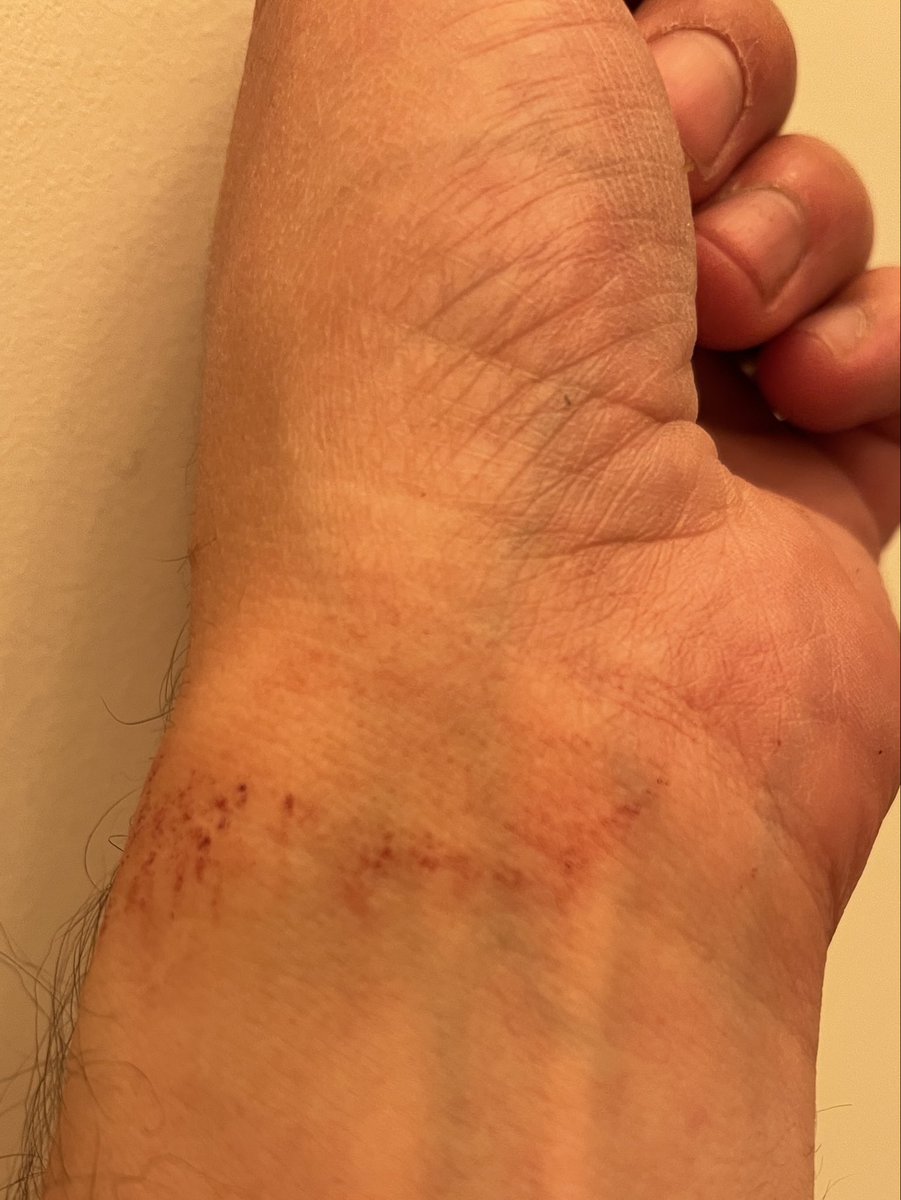 MasterDiff6's tweet photo. @MeatEaterTV Warm hands today https://t.co/Q0ITOTcuxs