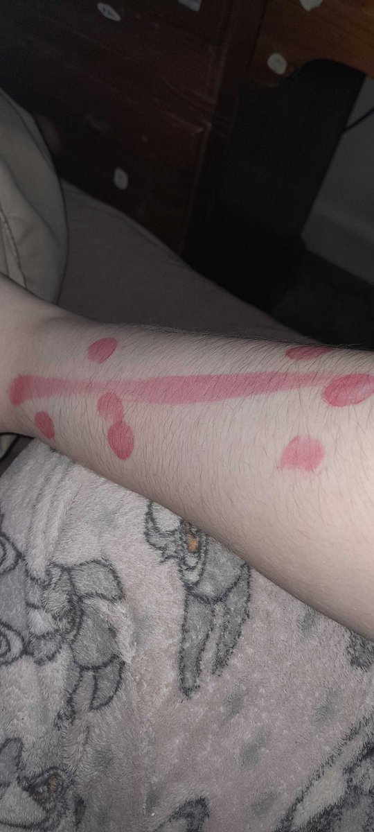 OVERSEEINGSHARK's tweet photo. // just woke up after apparently passing out, why tf did i wake up to ts on my arm 😭 https://t.co/utVn83uMpO