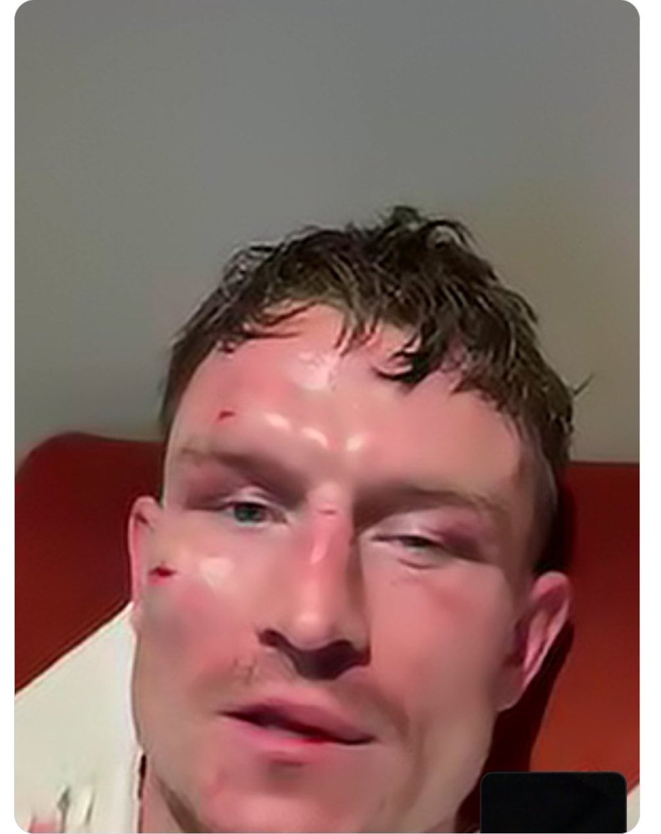 3TheHardWayTV's tweet photo. @DanRafael1 No clean shots. Only 63 punches landed fron Puello to do that?? https://t.co/bJEBmkWnzO