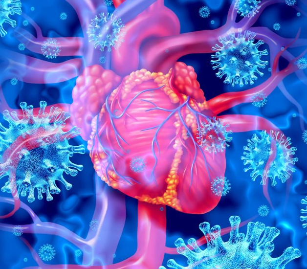 HarrySpoelstra's tweet photo. YOUR ATTENTION:

🚨Every new COVID-19 (re)infection elevates your cardiovascular risk profile. Even mild cases can raise the odds of a heart attack, stroke, heart failure, and other CV events for months to years afterward. Risk is higher with more severe illness, yes, but it’s certainly not limited to severe disease. Updated vaccination will show some mitigation(infection severity↓) but doesn’t give you a risk-free pass!
#AvoidSars2 #AvoidReinfections #UpdateVaccination

➡️Supportive links:
1. Xie et al., Nature Medicine (2022): Long-term cardiovascular outcomes of COVID-19 (elevated risk even in non-hospitalized patients, graded by severity).
https://t.co/oSX3XFdSQH
2. American Heart Association news release (2024) on the UK Biobank analysis (≈2× risk of heart attack/stroke/death for up to 3 years after any COVID-19 infection).
https://t.co/xB0RDOWCqz
3. Lindgren et al., Journal of Internal Medicine (2026): Nationwide Swedish matched cohort (nearly doubled long-term MACE and death risk in hospitalized cases, persisting beyond year 1).
https://t.co/pDh9R5D6eR
4. Hadidchi et al., Journal of Human Hypertension (2026): Elevated CV outcomes (including in non-hospitalized patients) among those with pre-existing hypertension.
https://t.co/8e8YxUDLQS
5. CARTESIAN study, European Heart Journal (2025):  Accelerated vascular aging / arterial stiffness after COVID-19, including mild cases:
https://t.co/qR4i1ZSmy7

➡️These five links give a clear progression from the early 2022 data through 2024–2026 confirmation!!