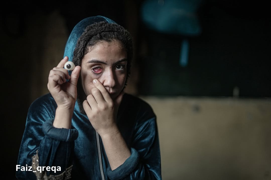 PalinfoAr's tweet photo. #صور| علاء عابد، طفلة فلسطينية تبلغ 15 عامًا، فقدت عينها اليمنى جراء قصف قرب منزل عائلتها في الشجاعية، واضطرت للنزوح مع أسرتها إلى مركز إيواء غرب غزة، وسط حاجتها إلى العلاج والرعاية النفسية.

تصوير: فايز قريقع https://t.co/xIAi2nprE3