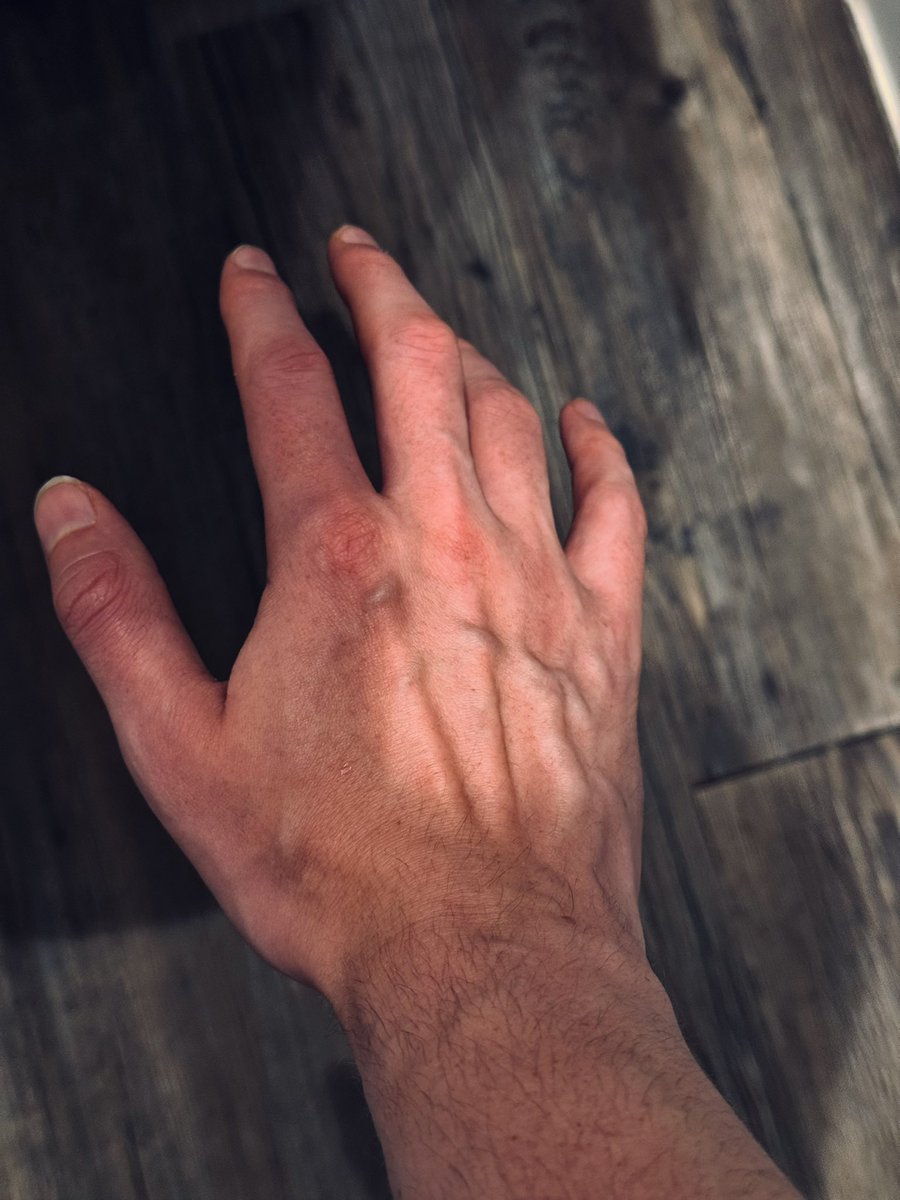 biddy007_'s tweet photo. gotta hold up for a series of daily hand pics ?? o.o https://t.co/h28dRncBqu