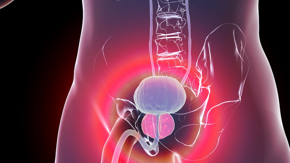 focusonline's tweet photo. Lassen Sie bei drei Anzeichen Ihre Prostata checken https://t.co/o7JwcsKdKs https://t.co/Pel0SG5GZP