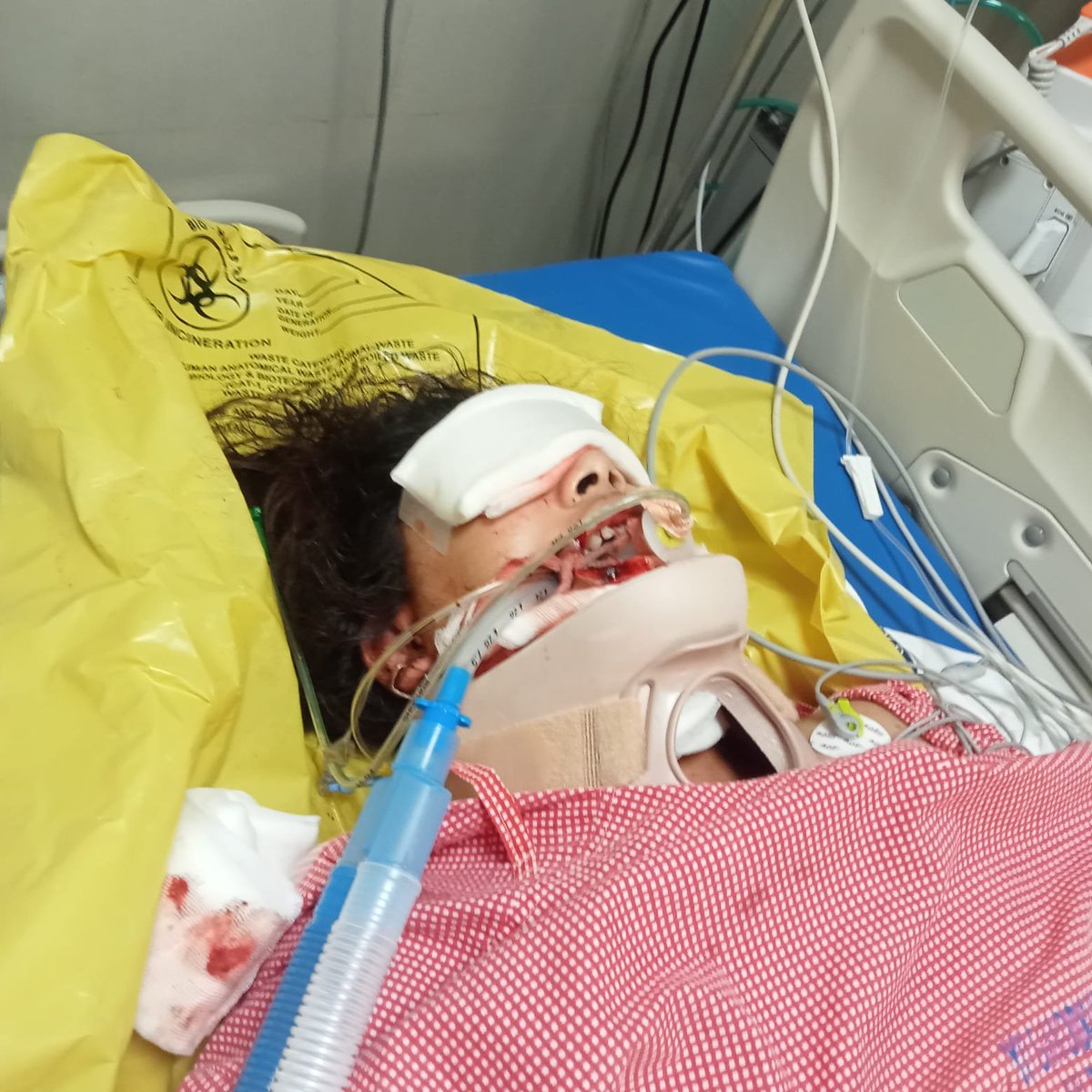 AmruthTalks's tweet photo. Dear @KTRBRS sir, exactly an yr ago i came to your ofc to have my enrlmnt and neck band ceremony. I beg u to extnd ur help to my neighbour who is 20 yrs old met with an accident. Father https://t.co/MPeJyj5zbX +919951397775
https://t.co/LyAzR18LuH

Even ur retweet matters. https://t.co/H0XDwphZw2