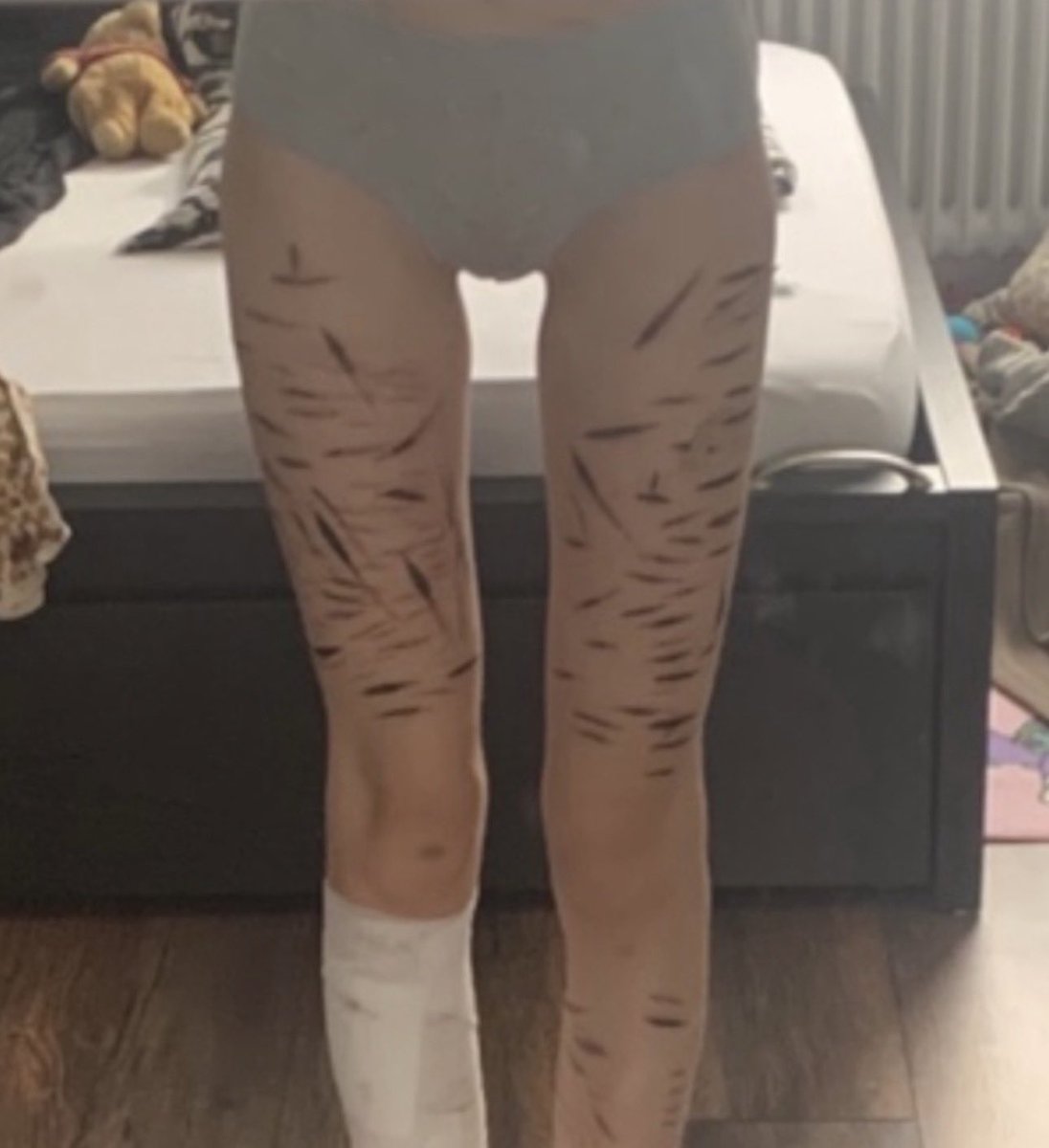clxrx08's tweet photo. new vs healed scars https://t.co/CR6oxMFMBw