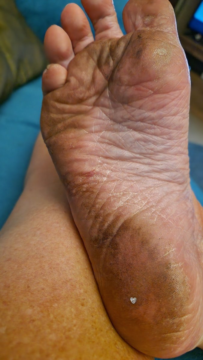 jaykaysand's tweet photo. This is how dirty my feet are right now https://t.co/DIB9UMIPcD