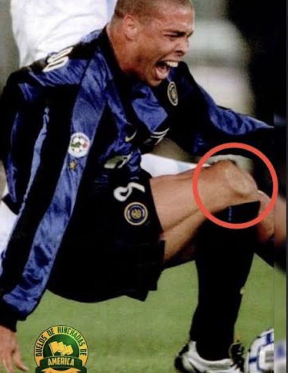 Bavaro_Arg's tweet photo. La rodilla de los jugadores con un mínimo de talento // La rodilla de Stanisic https://t.co/O4aA1vGi5j