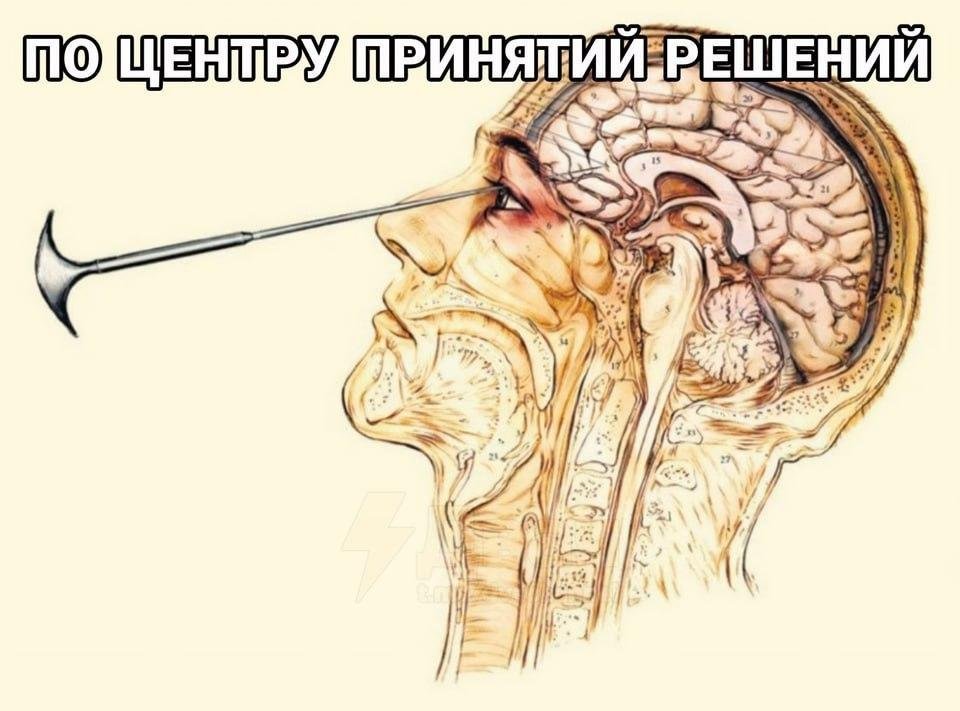 shkotobaza's tweet photo. ебаш https://t.co/QcQaCs3DNZ