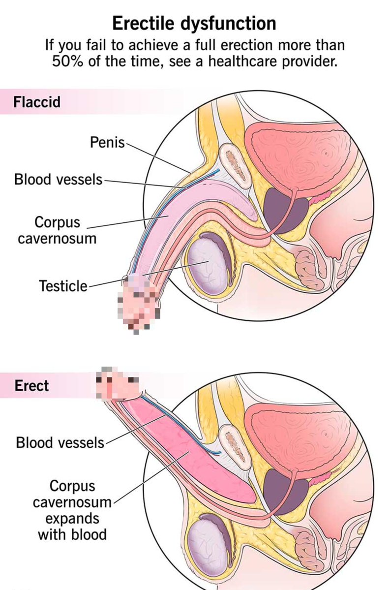 FitnessDadx's tweet photo. 5 EXERCISES THAT FIGHT ERECTILE DYSFUNCTION AT THE ROOT

One of these moves fixed or greatly improved ED in more than 3 out of 4 men who trained it.

1. Side-Step Lunge https://t.co/cvupdyWxQF
