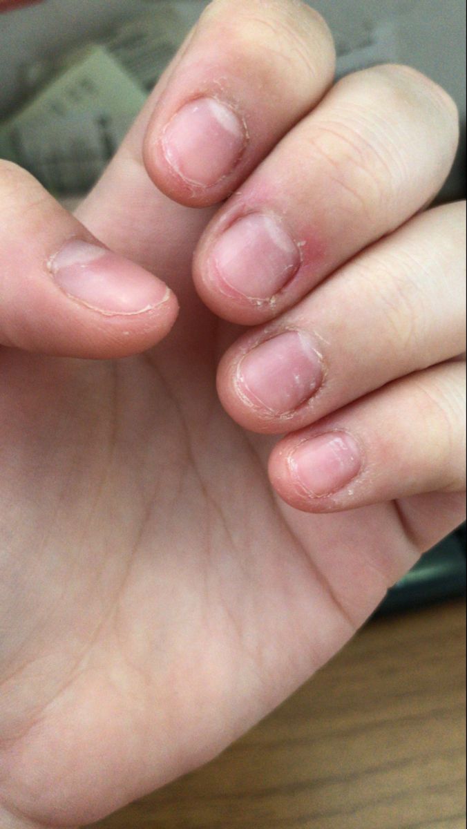 newusof's tweet photo. 6 hábitos que te hacen ver menos atractivo:

1. Morderte las uñas o los labios. https://t.co/LZHhrCWkKJ