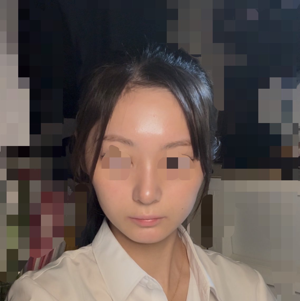 Db3r2vtVLw27685's tweet photo. 正面から見たらコレ
iPhoneカメラの動画で撮ったやつスクショした

まだまだ鼻先丸いし、なりより以前と違いすぎて違和感。
唇色ないし薄すぎるwww https://t.co/U4OT8Kzdh9