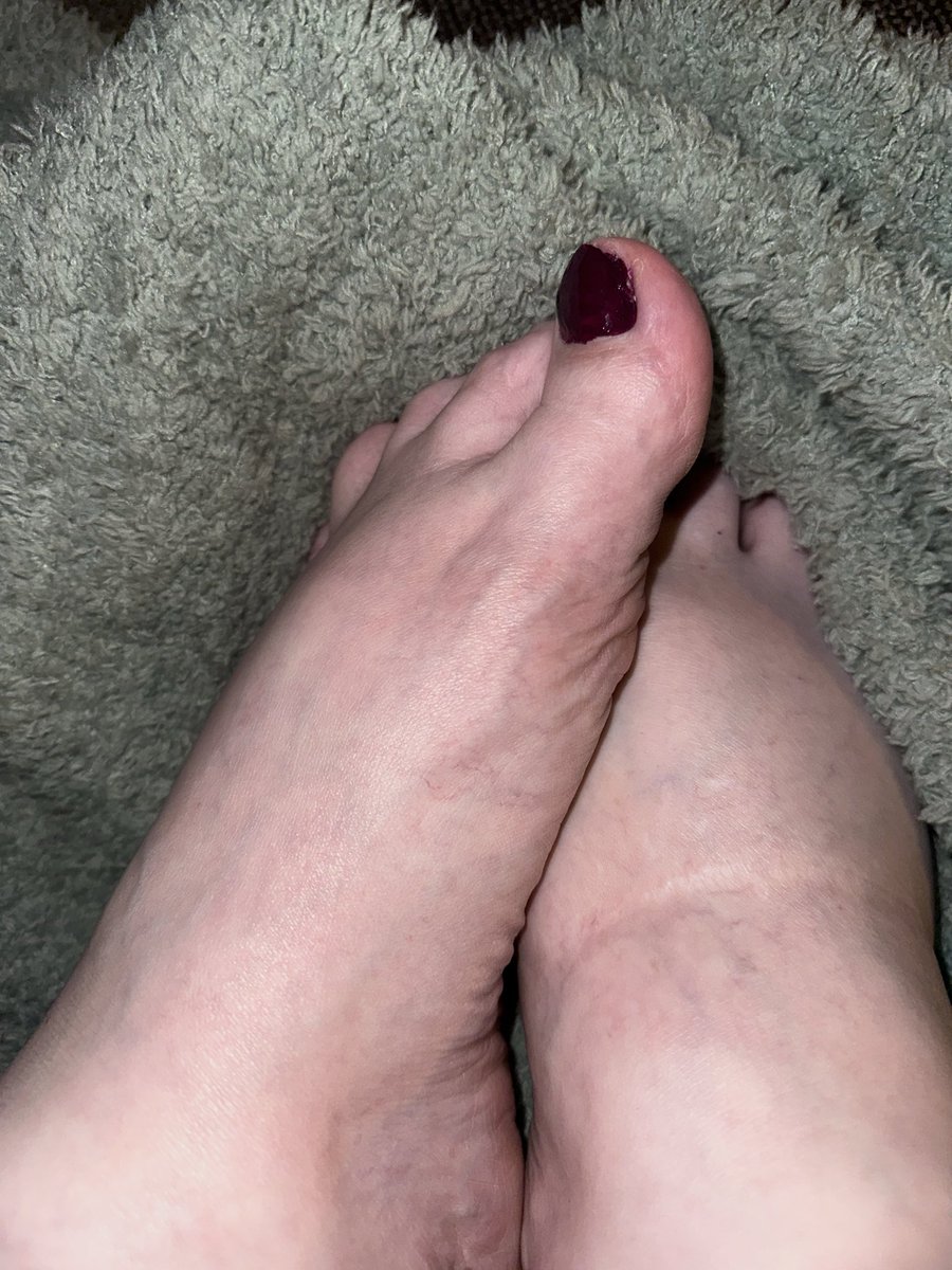 Punk_Petal_'s tweet photo. New color #feetfetısh #feetworshi̇p #selling_content https://t.co/xlQNpy8GyV
