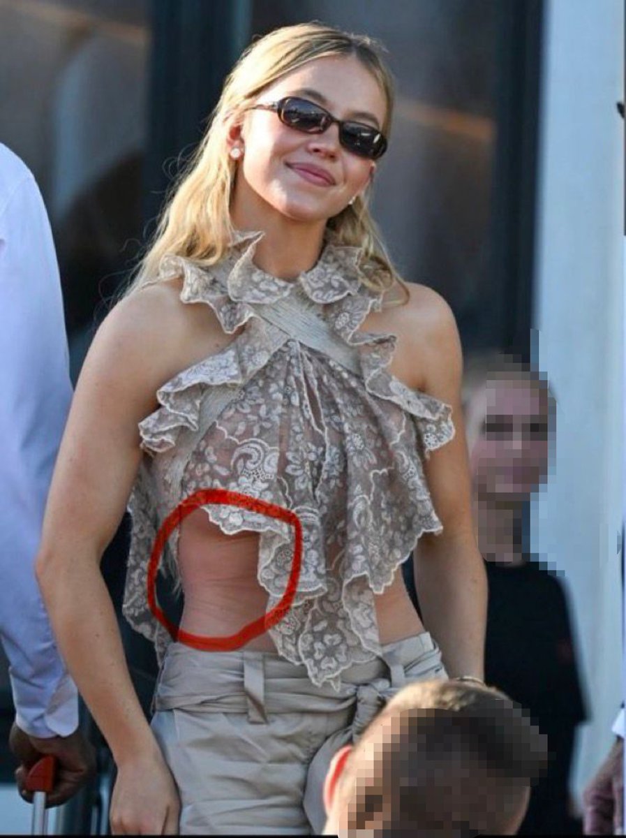 Stevetweetzz1's tweet photo. Hey @grok ,can you explain what that circled mark on Syndey Sweeney's ribs actually is?👀🤔 https://t.co/QKDwjkChj6