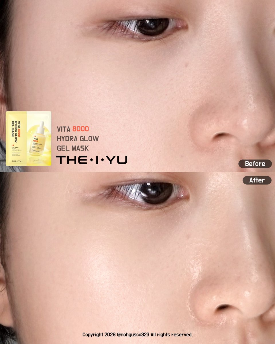nohgusco323's tweet photo. [광고] #RT이벤트 #현채이벤트

#RT 해주신 팔로워 3분께
더이유 비타 8000 하이드라 글로우 겔마스크를 보내드립니다!🎁

공쥬들!! 중요한 날 메이크업 전에 쓰기 좋은 겔 마스크팩 발견했어요!🥹💛

피부에 올리자마자 느껴지는 시원한 쿨링감에 
얼굴 붓기가 싸-악 가라앉고
떼어낸 후에는 피부가 촉촉탱탱해지는 걸 실시간으로 체감할 수 있었어요..✨

🔗 더이유 비타 8000 하이드라 글로우 겔마스크 바로가기 
https://t.co/b5z7W9Pcqs 

👇 후기는 타래로 계속됩니다.ᐟ