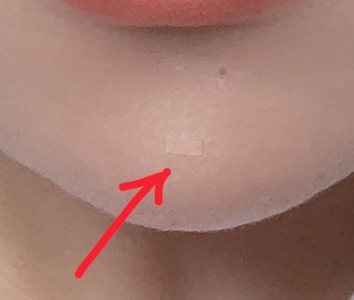 poyop18's tweet photo. これを小さくカットして、上からコンシーラーとかいつものベースを乗せたらほくろ隠せたよ🎶
ノーマルカメラでなくてゴメンネ💦 https://t.co/UxLDyN5GG3