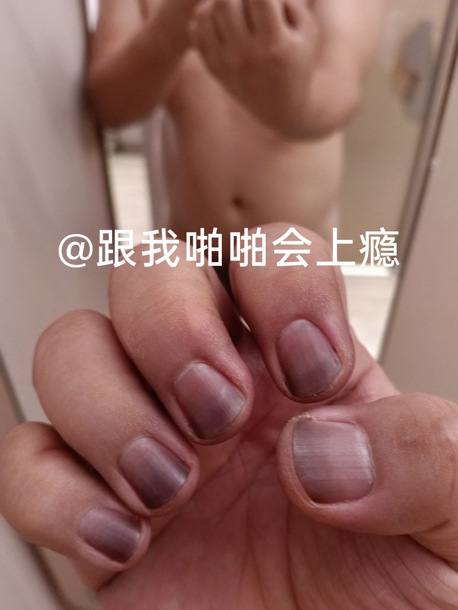amable34's tweet photo. 杭州的垃圾怎么这么多啊？无聊的把我小蓝账号举报封号！艹
只能又新注册了，名字头像还是之前的！辛苦各位粉丝再重新搜索关注啦！！！ https://t.co/gEWQjIz6F1