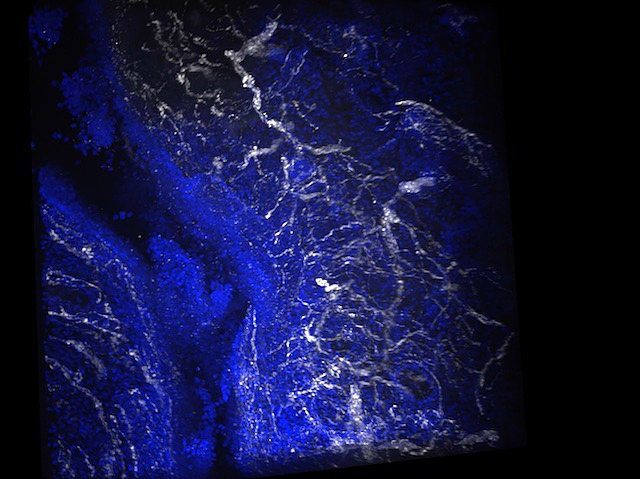 BPoD_s's tweet photo. How allergic inflammation engages sensory neurons => debilitating effects incl. pain in the food allergy response eosinophilic oesophagitis

📹 @KKellermanUCCOM et al @CincyChildrens in @NatureComms 
➡️ https://t.co/FPNBPClGwi https://t.co/iTc9iqHJeG