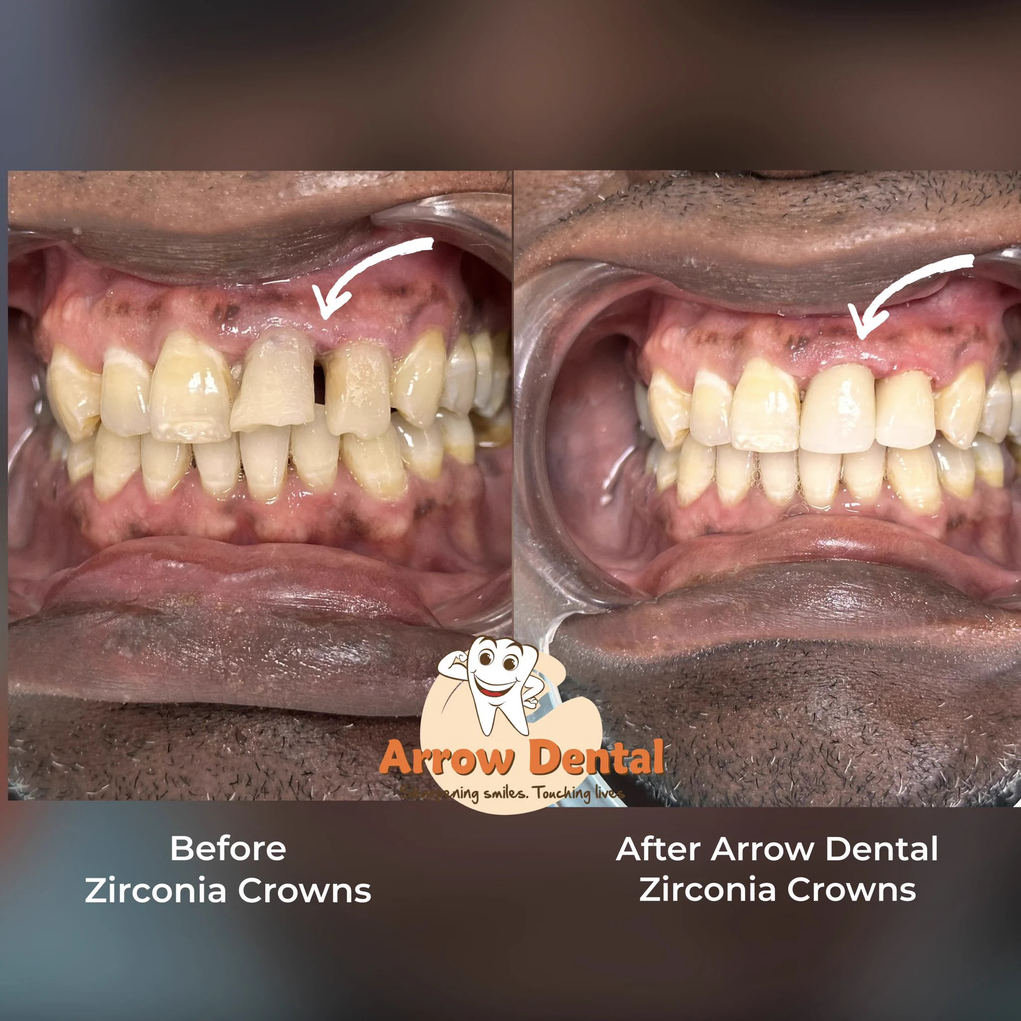 Arrow Dental Centre on X: 
