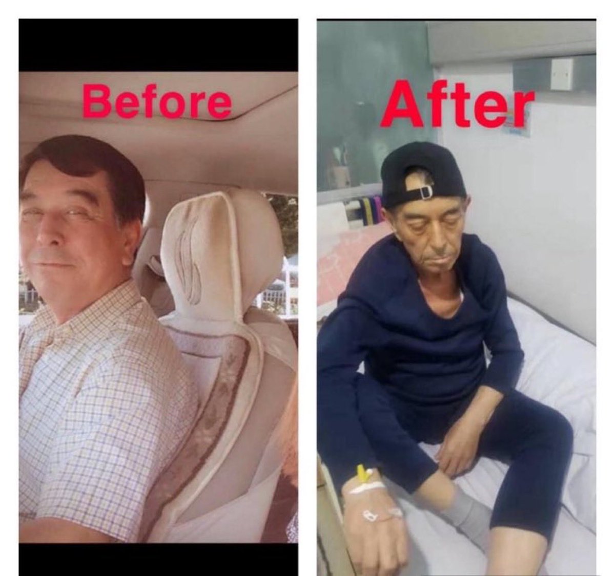 Uyghur_Report's tweet photo. Çin’in toplama kamplarında tutulan Uygur Türklerinin kamp öncesi ve sonrasına ait görüntüler, maruz kaldıkları işkenceleri yeniden gündeme taşıdı.

#UygurTürkleri https://t.co/DiBD3nD1q2