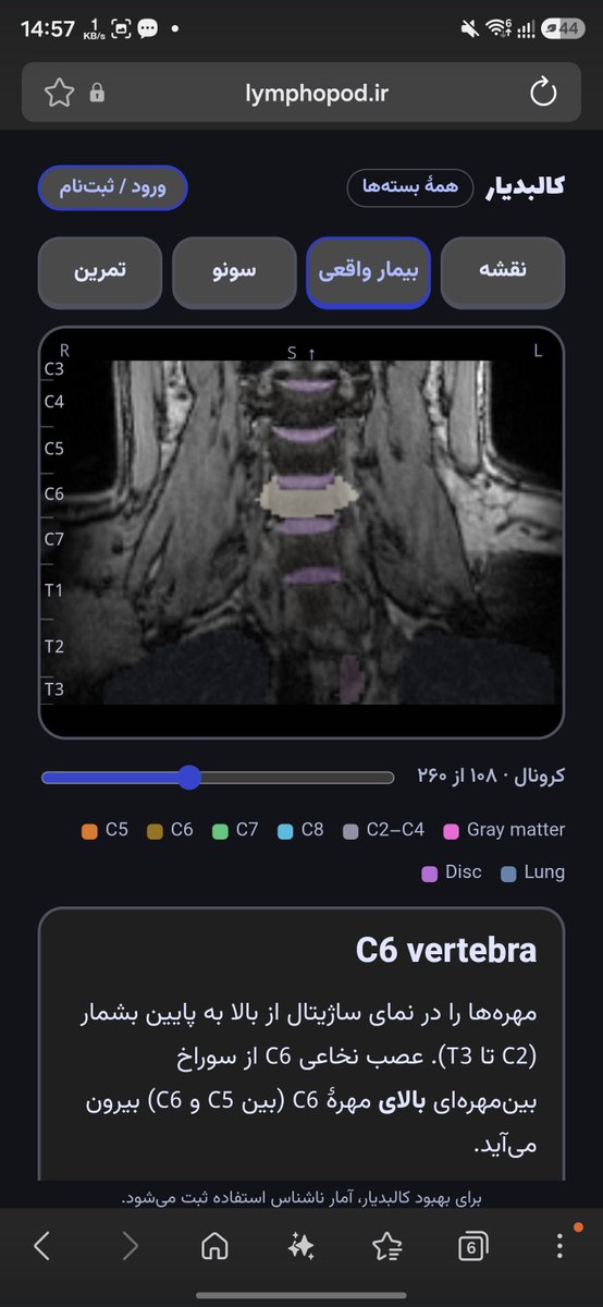 mahziar99's tweet photo. یکی‌از بزرگترین مشکلاتم توی دوران تحصیل پزشکی، خوندن آناتومی بود، درک سه بعدی برای من کار خیلی سختی بود مخصوصا اینکه دسترسی به مولاژ های دانشگاه هم سخت تر... یک اپلیکیشن ساختم برای آناتومی که سونو و mri و ct هم داره... دوس داشتین استفاده کنین:
https://t.co/6G1zYQCgft https://t.co/yrUkOx5t3L