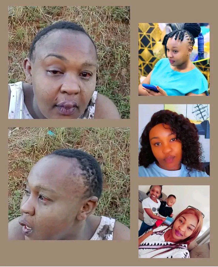 kijana_misa's tweet photo. Lydia Chemu’s story is one that stays with you.

In 2015, her life looked full of promise. She married a gospel artist and pastor. Their union was rooted in faith, and soon they welcomed a beautiful daughter. For a while, everything seemed steady.

Then 2019 came, and the marriage collapsed. Hoping for a new beginning, Lydia entered a second relationship with a man named Kim Jerry. They had a child together. What followed was years of pain.

According to Lydia, the home became a place of daily violence. Kim would beat her over the smallest things. There were nights he came home late and, in acts that still shock those who hear them, threw the children through the window. He constantly reminded her firstborn that he was not her real father and forbade the little girl from calling him dad.

When her former husband learned of the abuse, he stepped in and took their daughter to live with his family.

Lydia and Kim later moved to Nairobi after he found work. When the job ended, they were evicted over unpaid rent. A friend in Rongai offered them a place to stay, but the violence continued until the homeowner could no longer watch and asked them to leave.

Lydia finally returned to Eldoret, leaving Kim behind. They later reunited after he promised to change. The promise did not last. The assaults started again.

She says she cannot easily return to her parents because of personal issues, leaving her feeling trapped between pain and limited options.