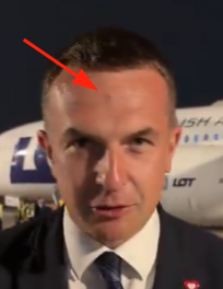 ronczykiewicz's tweet photo. @adamSzlapka Od tej Indyjskiej gnozy to zaczyna mu się trzecie oko otwierać ;p https://t.co/3yv6kdyHxV