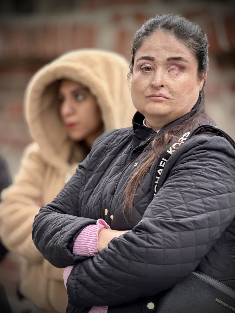 PamelaParesky's tweet photo. This brave woman, @FahimaSarfaraz, was blinded when her Taliban ex-husband threw acid in her face. He laughed &amp; said she could never be the voice of freedom—because people would be afraid of her.

She told her story to a huge crowd in Poland. And she said, “He didn’t win. I win.” https://t.co/UVgO9srom1