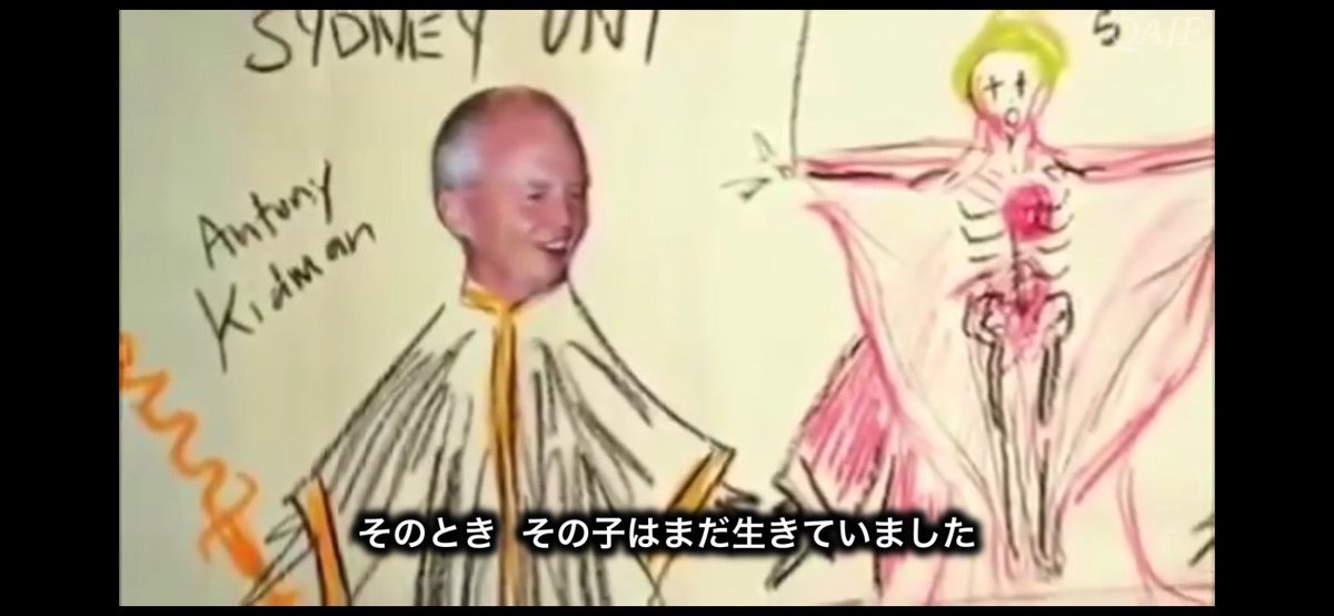Maika3gou's tweet photo. パックン、国民を騙せなくなってきて
ヤツらの行う悪魔崇拝儀式で妻を生贄をしたか⁉️#あり得る
 
https://t.co/xt3Xu1Gqhy https://t.co/ogrqcFCEl8