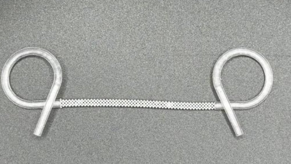 TheEngineerUK's tweet photo. 3D-printed biodegradable stent boosts gastric leak drainage - The Engineer https://t.co/JbpZtaRtu9 https://t.co/VlBlY8V8pW
