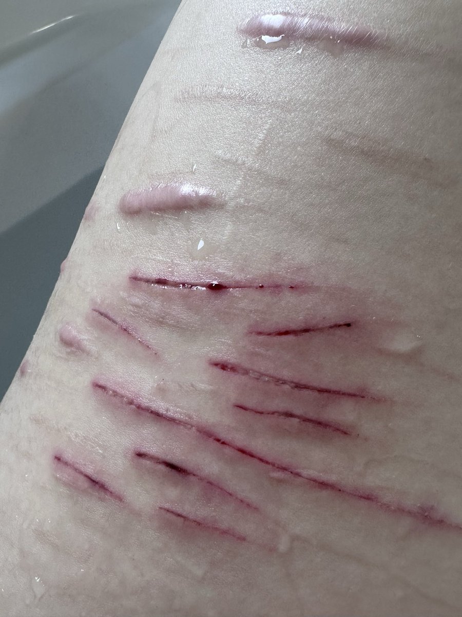 Bunnilui's tweet photo. Hello #shtwt twt keeps taking down my posts😢 but face reveal and some recent cuts.. 

all sfx/makeup https://t.co/2Q6W27vOFM