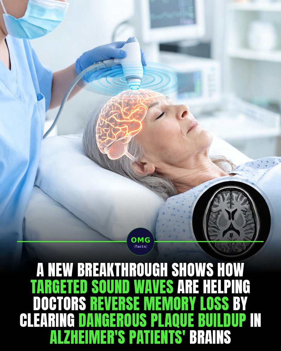 OMGFacts's tweet photo. 🧠 Sound waves may fight Alzheimer's in the brain.

Ultrasound + microbubbles open the brain's barrier.

No drugs, no surgery needed.

Sources: NEJM, WVU Rockefeller

#omgfacts #Alzheimers #Neuroscience https://t.co/OP3y9C7PX5