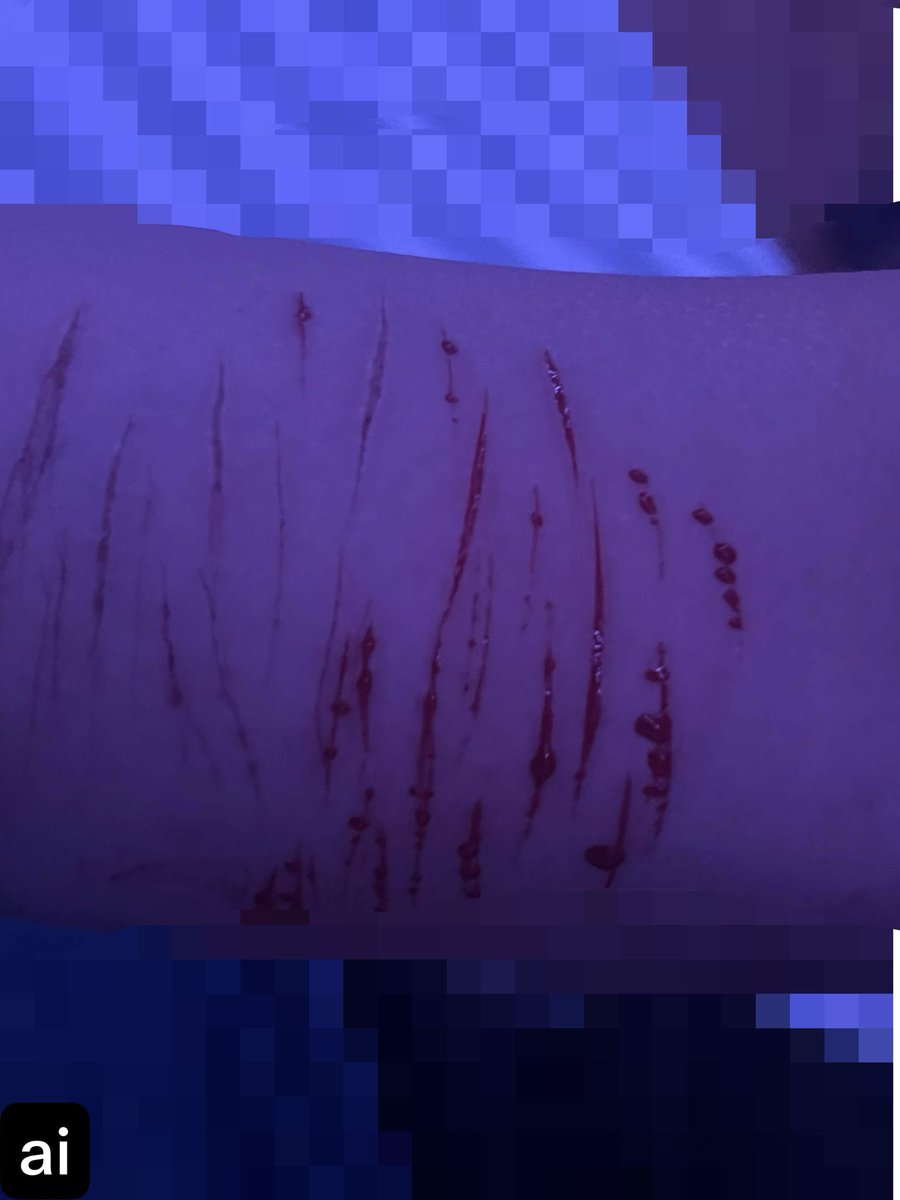 normiebozo's tweet photo. My friend did those for mee hehe some are cat scratches others styros 😋

#kohane #slitwt #sfxmakeup #makeupsfx #shedtwt https://t.co/HwZ2OFblkF