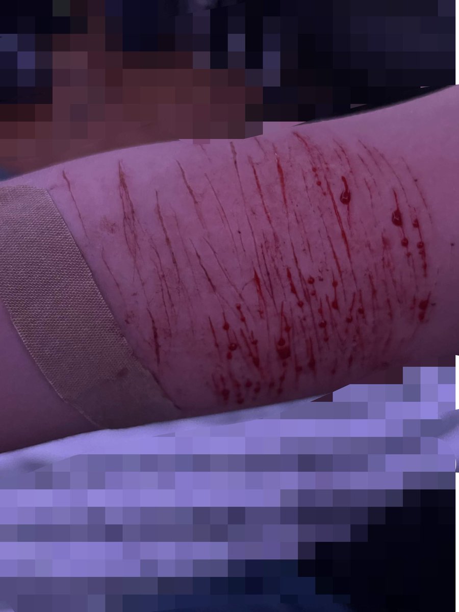 normiebozo's tweet photo. My friend did those for mee hehe some are cat scratches others styros 😋

#kohane #slitwt #sfxmakeup #makeupsfx #shedtwt https://t.co/HwZ2OFblkF