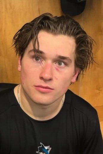 rawfearss's tweet photo. the infamous aviator accident…the way he kinda looks like he fell in the pool completely wasted right before the last picture and smacked his face with the glasses on into the cement siding while trying to swim up 😭 https://t.co/C9hoNqQpaf