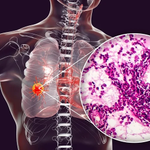Photo by AMS-Composites (@AMSCompositeC)