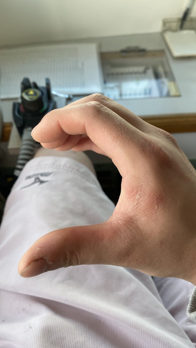 7jpd_'s tweet photo. 手を酷使してる漁師ですが浮腫んでいようが傷だらけであろうがゲームしたいです https://t.co/8PXAjoziAu
