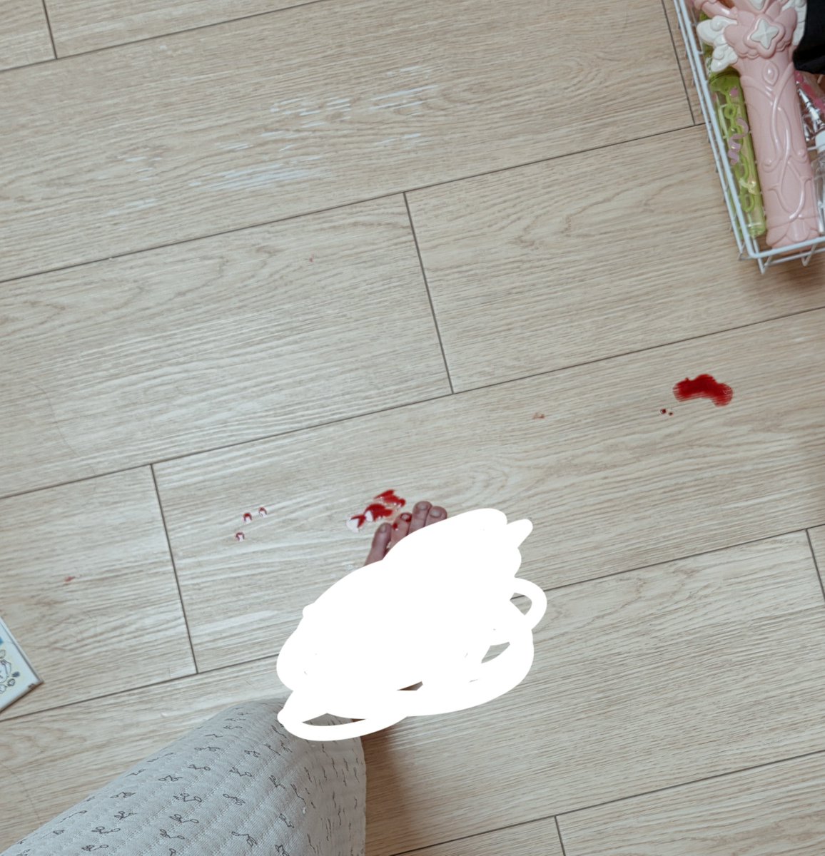 _Milotti's tweet photo. 피여서 민컴 설정했어요

이런사진 올려서 죄송합니다.
다들 속눈썹 집게나 네일용 집게 꼭 조심하세요..전 고통을 잘 참는 편이어서 괜찮았는데
아예 집게가 한번 박혔다 다시 튀어서 다른곳에 박혀서 피바다가 되었어요. 입구 모아주는 실리콘 팁이 있는 줄 알았는데 없어져서 이런일이 일어났습니다 https://t.co/OmVP3yX07k