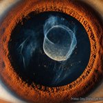 Photo by Haag-Streit Diagnostics (@HSDiagnostics)