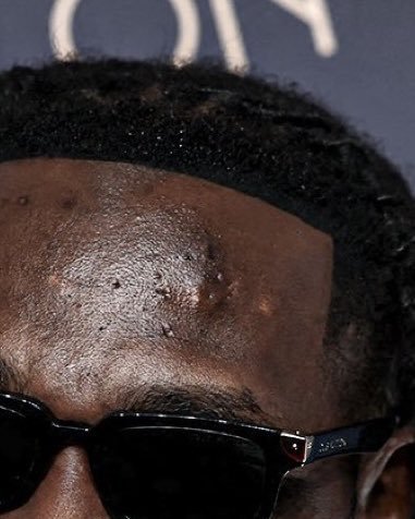 NEXTKING_01's tweet photo. Dirty or pimples

#burnaboy
#Entertainment
#music https://t.co/goI8rWRxAq