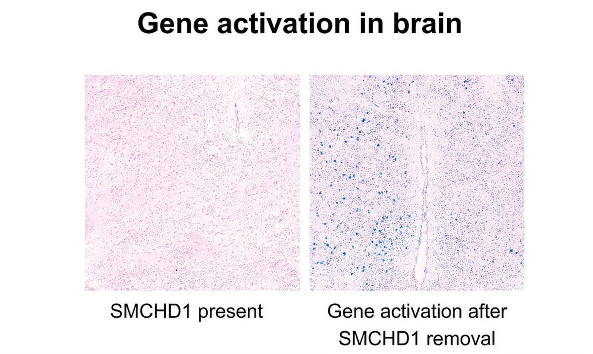 rarebiogen's tweet photo. Switching on healthy silent genes reveals new way to treat Prader-Willi syndrome dlvr.​it/TW4qp2 https://t.co/DYxjhL3ctP