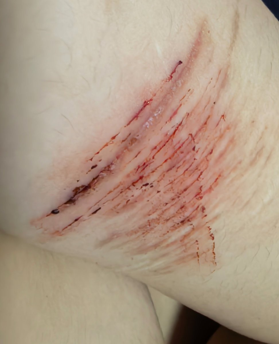 seriserip tweet picture