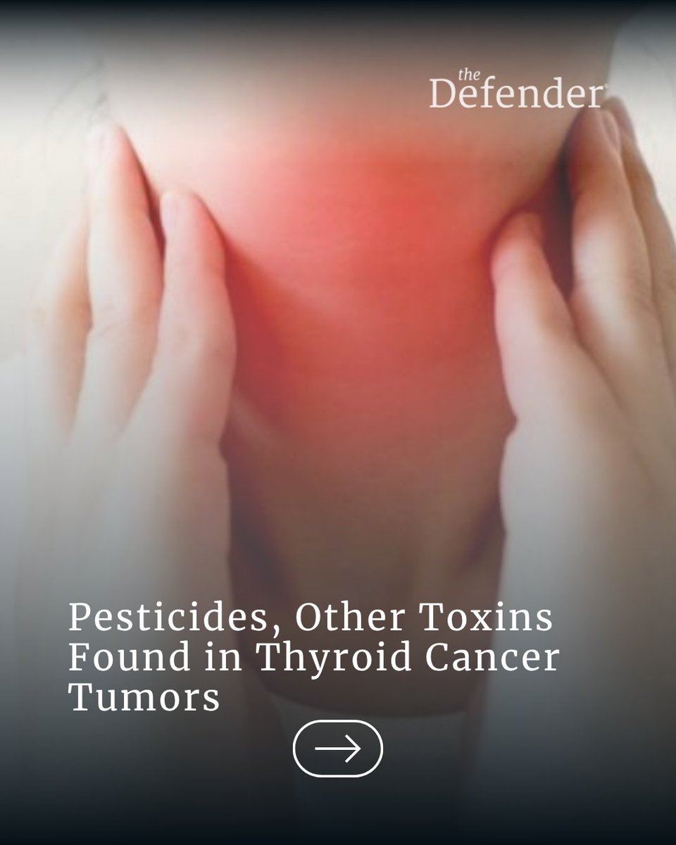CHD_TheDefender's tweet photo. Environmental chemicals found inside human tumors!

Researchers examining thyroid cancer tissue identified 442 different chemicals, including pesticides, plasticizers, PFAS, flame retardants and other contaminants. About 40% were classified as potential endocrine disruptors. https://t.co/rVstPmBosx