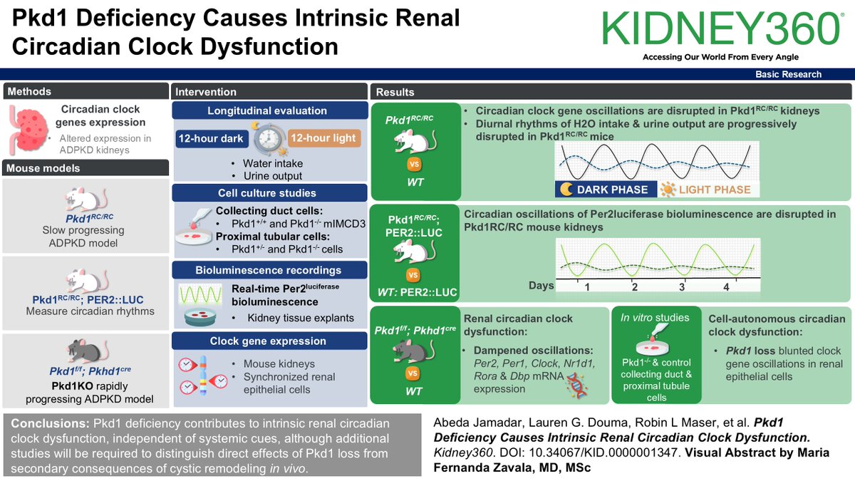 asnpublications's tweet photo. Our kidneys have their own “body clock.” A #basicresearch study in #ASNKidney360 suggests that in ADPKD, that clock may be disrupted as cysts grow. Researchers hope these findings could lead to new ways to protect kidney function in the future. https://t.co/UuBztS8A2M https://t.co/cK9BF94UV9